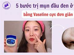 Lấy Mụn Đầu Đen Ở Mũi Bằng Vaseline